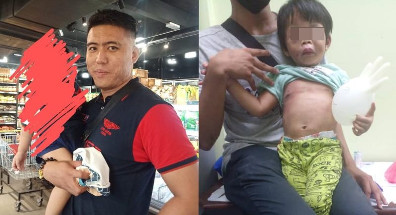 Nur Raisha, dipukul menggunakan penyangkut baju oleh teman lelaki ibunya, Amir Shafiq sehingga lebam di bahagian muka dan seluruh badan.