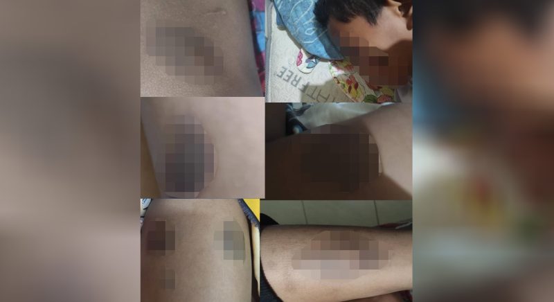 Murid dibuli rakan sekolah