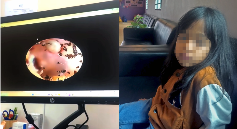 Telinga anak jadi sarang kutu babi
