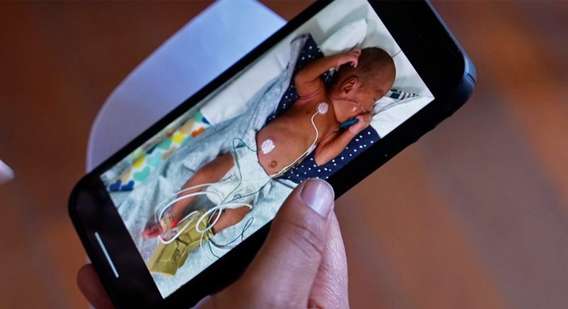 Jururawat sengaja patahkan tulang bayi