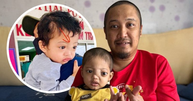 Kanak-kanak kehilangan penglihatan akibat kanser saraf tahap empat