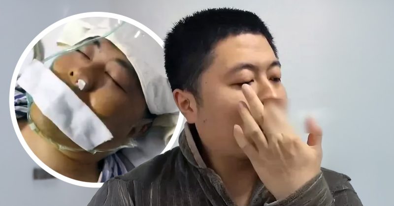 Lelaki jalani pembedahan kecemasan akibat arteri pecah selepas kerap korek hidung.