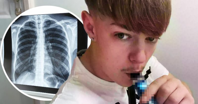 Remaja batuk darah akibat penggunaan vape secara berlebihan.