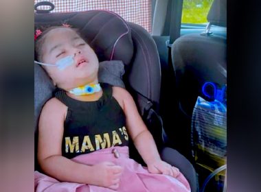 Seorang kanak-kanak perempuan terlantar di kerusi kereta dengan tiub pernafasan dan alat perubatan, mencerminkan derita akibat FIRES Epilepsy.