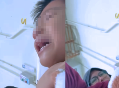 Kanak-kanak lelaki 7 tahun mengalami kecederaan saraf kaki akibat kemalangan jalan raya.