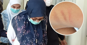 Guru taska didenda selepas kanak-kanak autistik dipukul menggunakan hanger